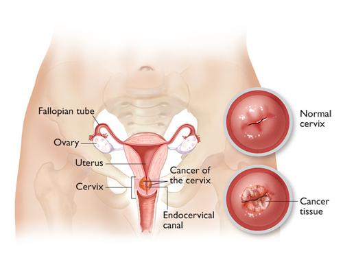 cervical diagram 2