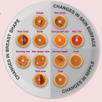 Breast Cancer Screening & Mammogram Singapore | Singapore Cancer Society